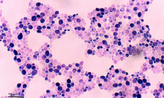 Candida Albicans, existent-ils des traitements sans ordonnance ?