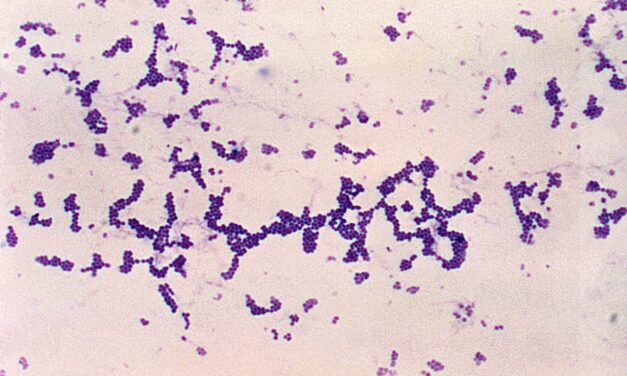 Cocci gram positif : formes et identification