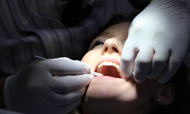 Implant dentaire : pourquoi y avoir recours ?